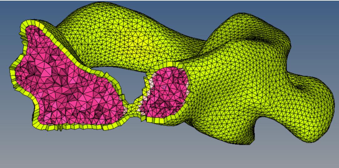 HyperMesh Image 1